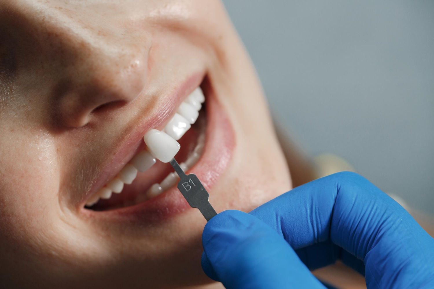 Dentista revisando los dientes