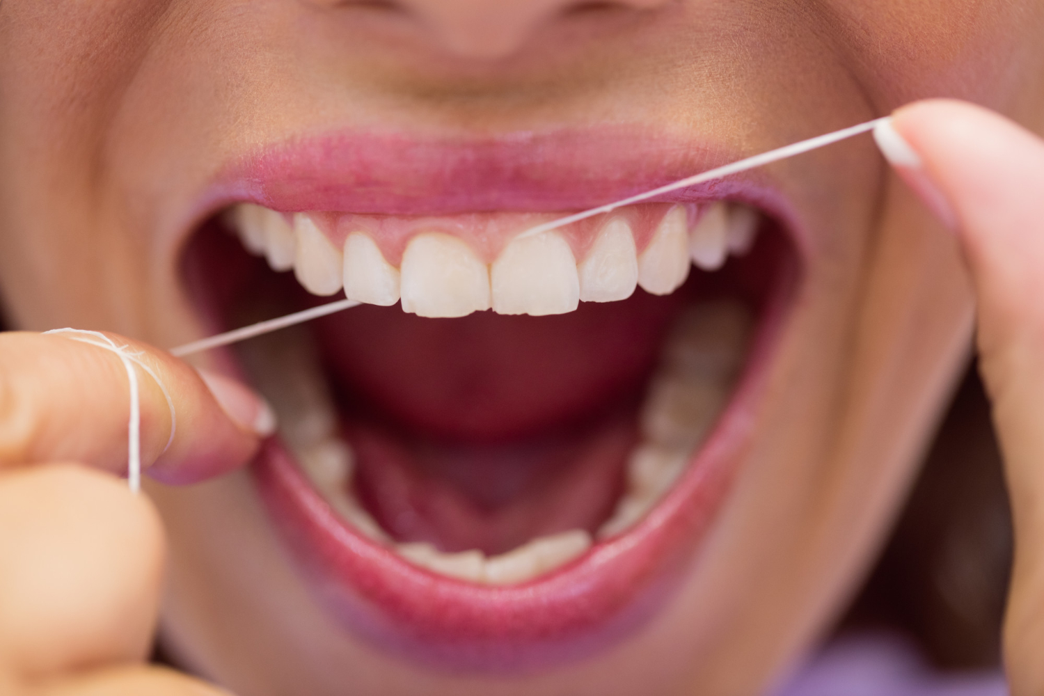 Dentadura dientes